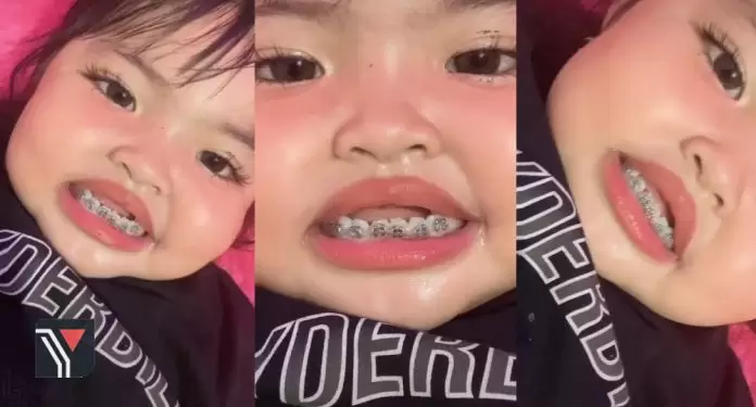 [VIDEO] Netizen Kecam Tindakan Ibu Bapa Pakaikan Anak Kecil Pendakap Gigi – ‘Kasihan Dia, Sakit Tu’ 10